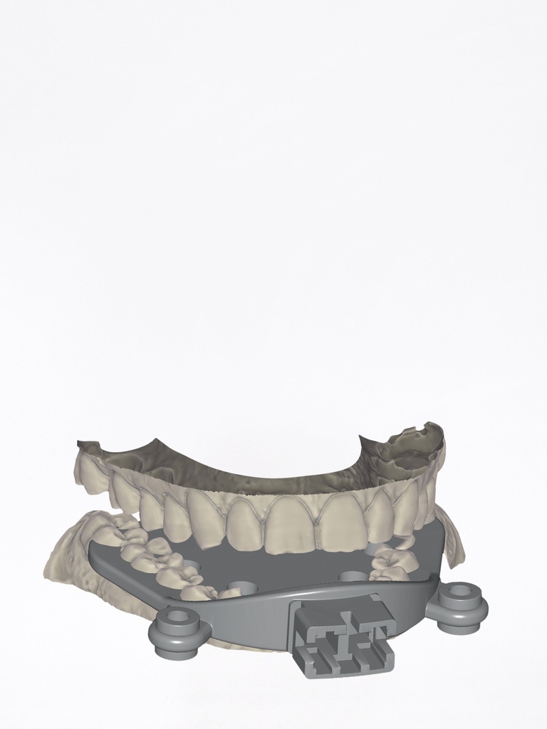 ChairsideCAD - Modulo Jaw Motion