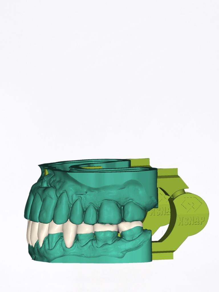 DentalCAD - Modulo xSNAP Flex