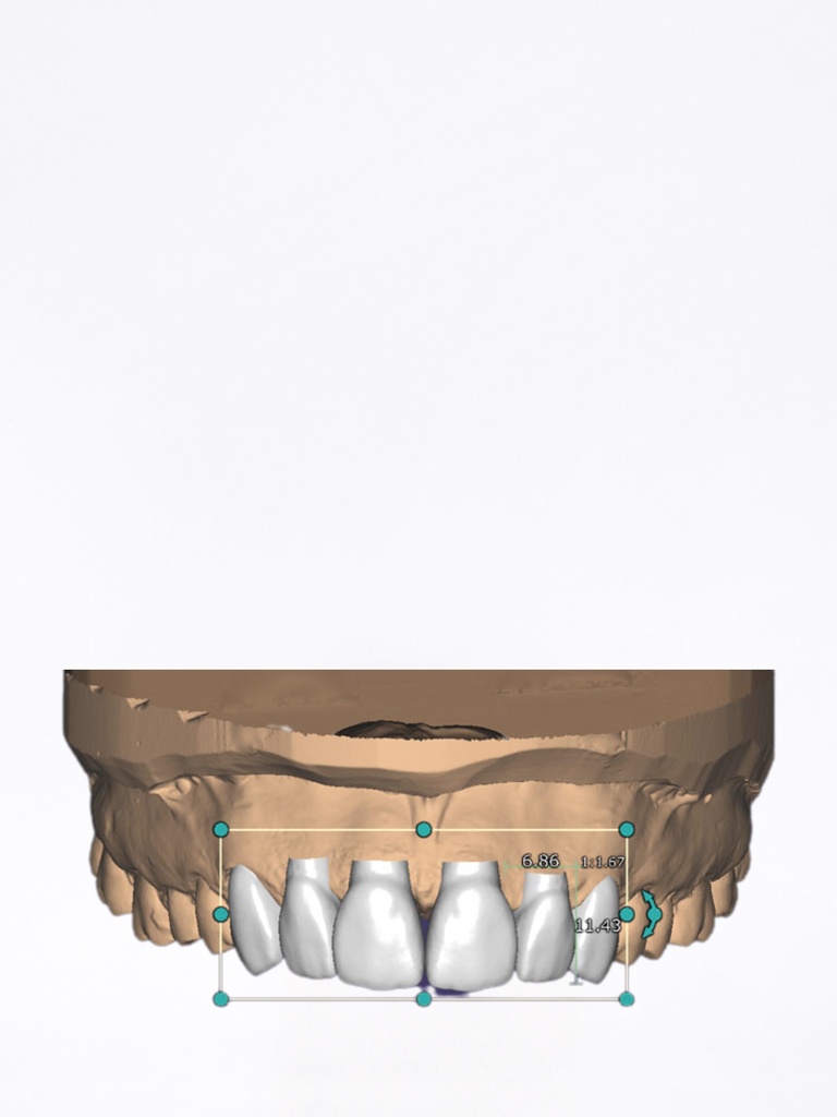 DentalCAD - Modulo Smile Creator