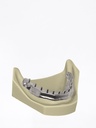 DentalCAD - Modulo Barre Flex