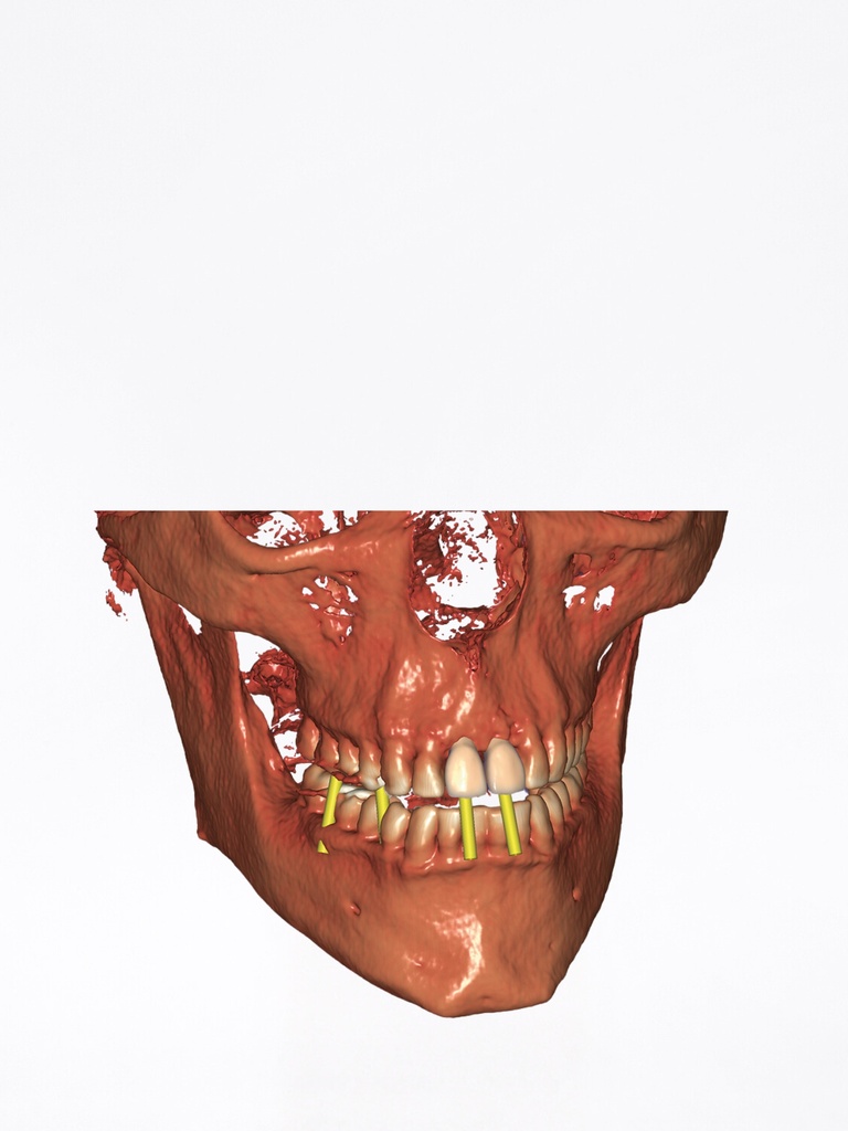 DentalCAD - Modulo DICOM Viewer Flex