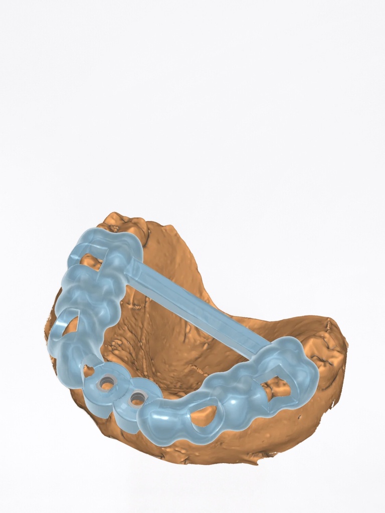 exoplan - Modulo Guide Creator
