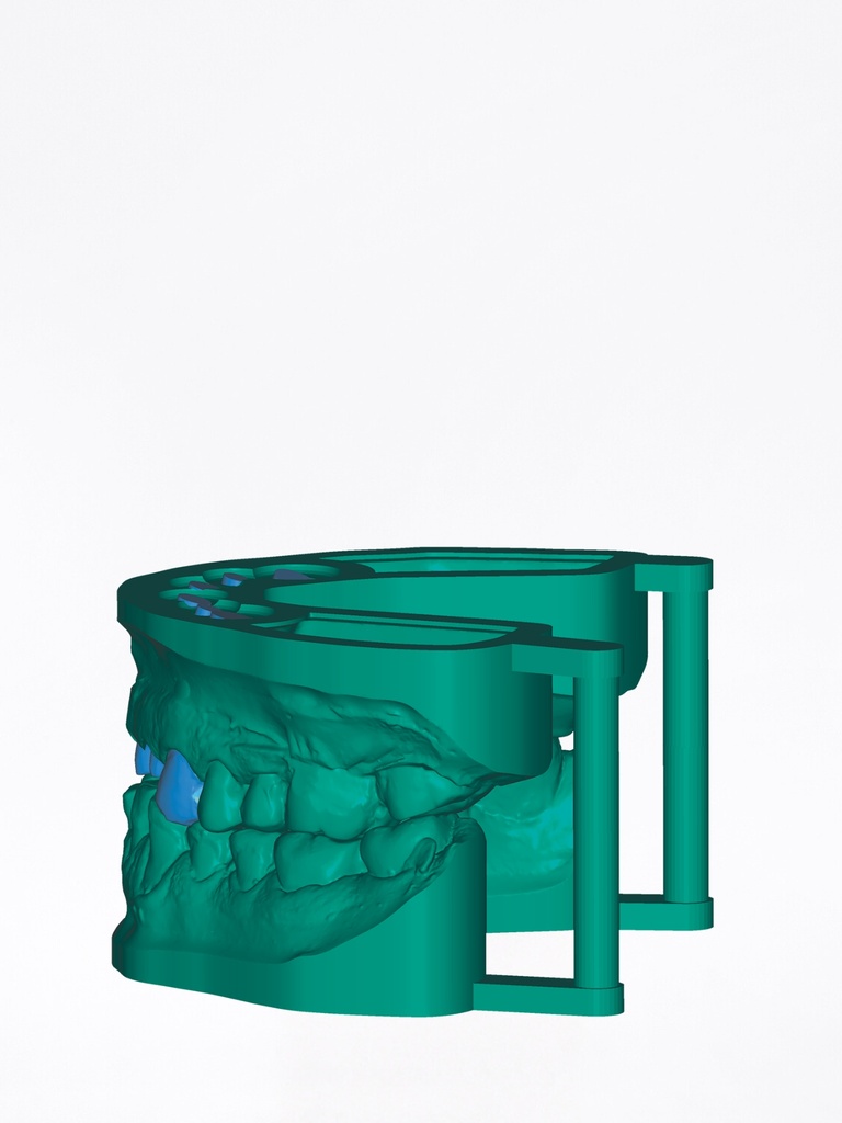 ChairsideCAD - Modulo Model Creator Stand Alone