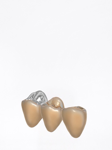 DentalCAD - Modulo TruSmile