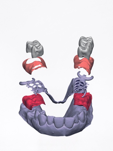 DentalCAD - Modulo PartialCAD Flex