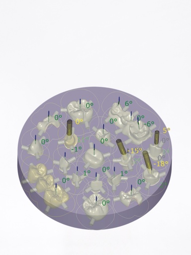 DentalCAD - Modulo Nesting Flex