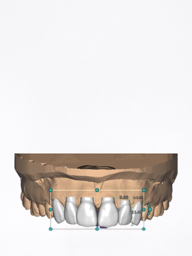 ChairsideCAD - Modulo Smile Creator